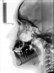 Jaw Pain | Cause & Effects Image