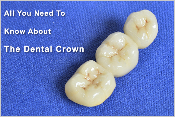 Dental Crown Image