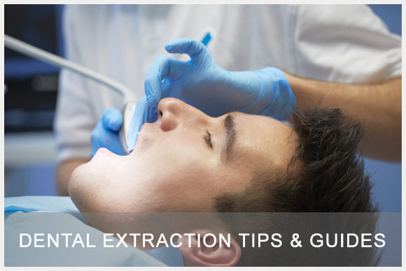Dental Extraction Tips Image