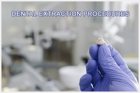 dental extraction Image