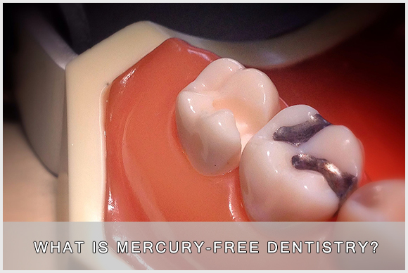 Mercury Free Dentistry Image