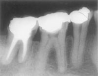 dental x-rays