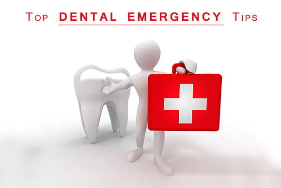 Top Dental Emergency Tips Image