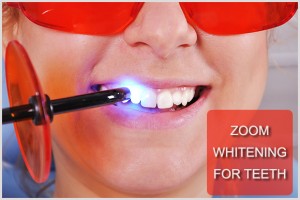 Zoom Whitening Teeth Info.